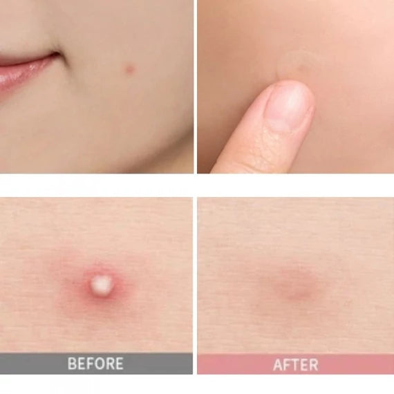 Skin1004 Madagascar Centella Spot Cover